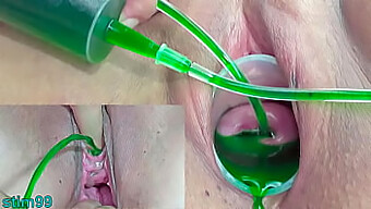 Japanese Mature Lesbians Experiment With Gynecological Procedures